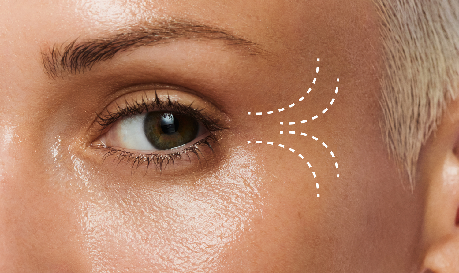 Zdjęcie modelki z zaznaczonymi zmarszczkami, które da się wygładzić przy pomocy odpowiednich składników aktywnych - argireliny